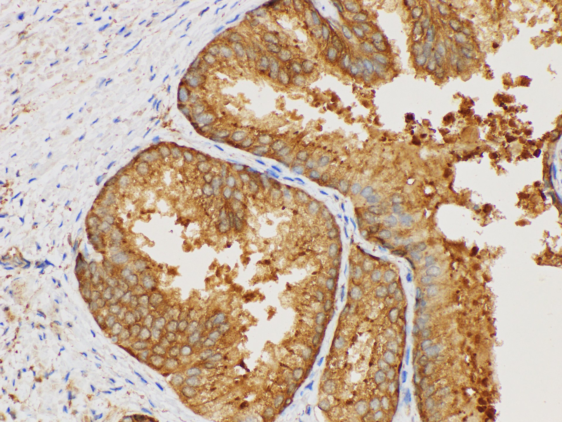 Immunohistochemistry of paraffin-embedded Human prostate using MIF Polycloanl Antibody at dilution of 1:50