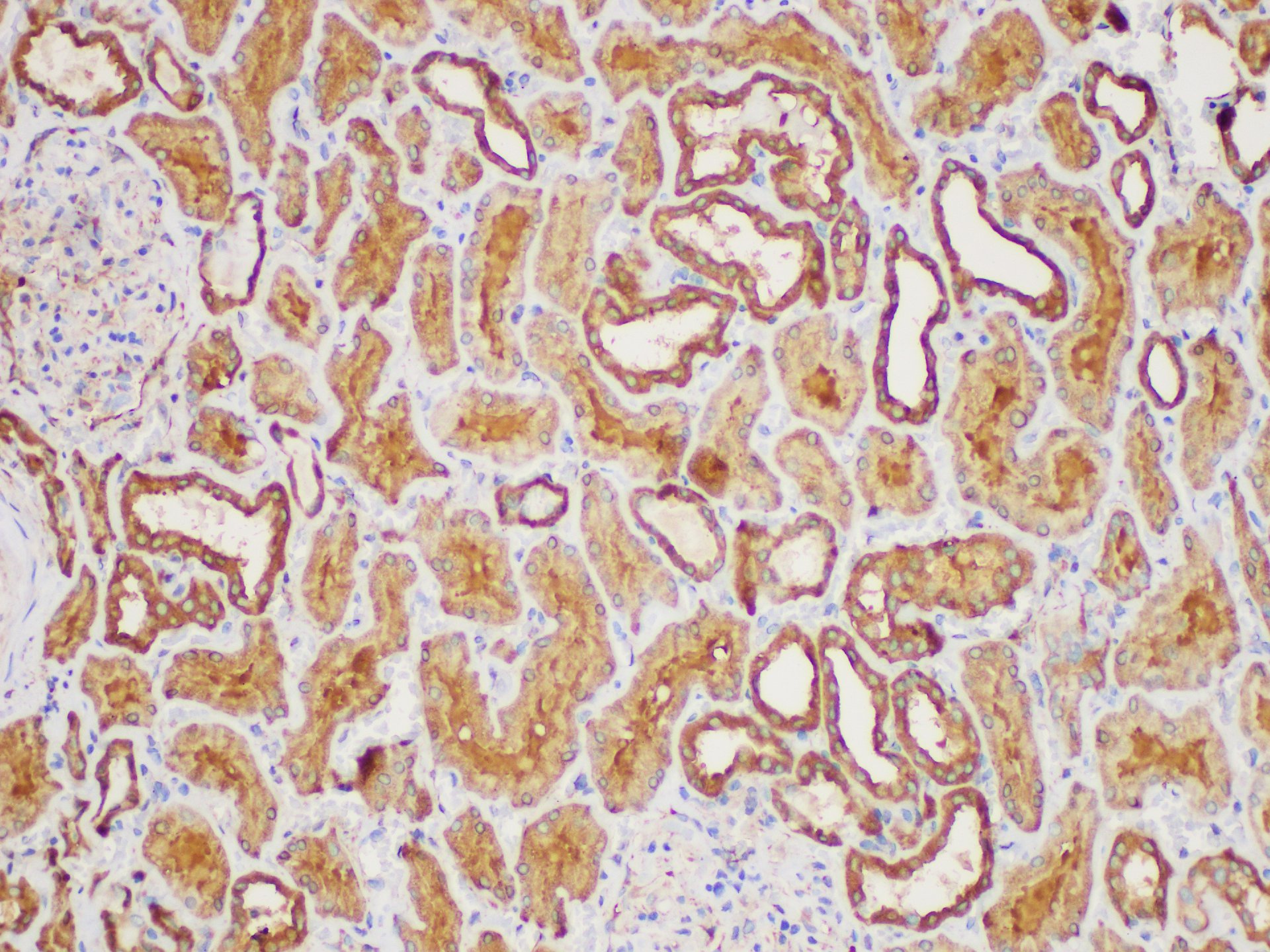 Immunohistochemistry of paraffin-embedded Human kidney using MIF Polycloanl Antibody at dilution of 1:50