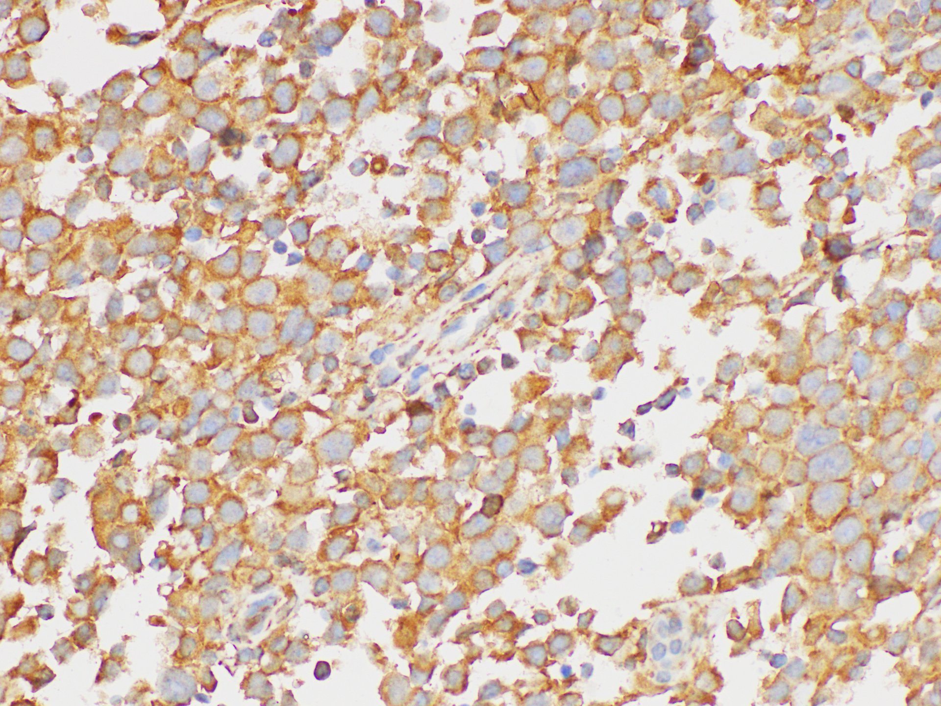 Immunohistochemistry of paraffin-embedded Human testis using PAIP1 Polycloanl Antibody at dilution of 1:200