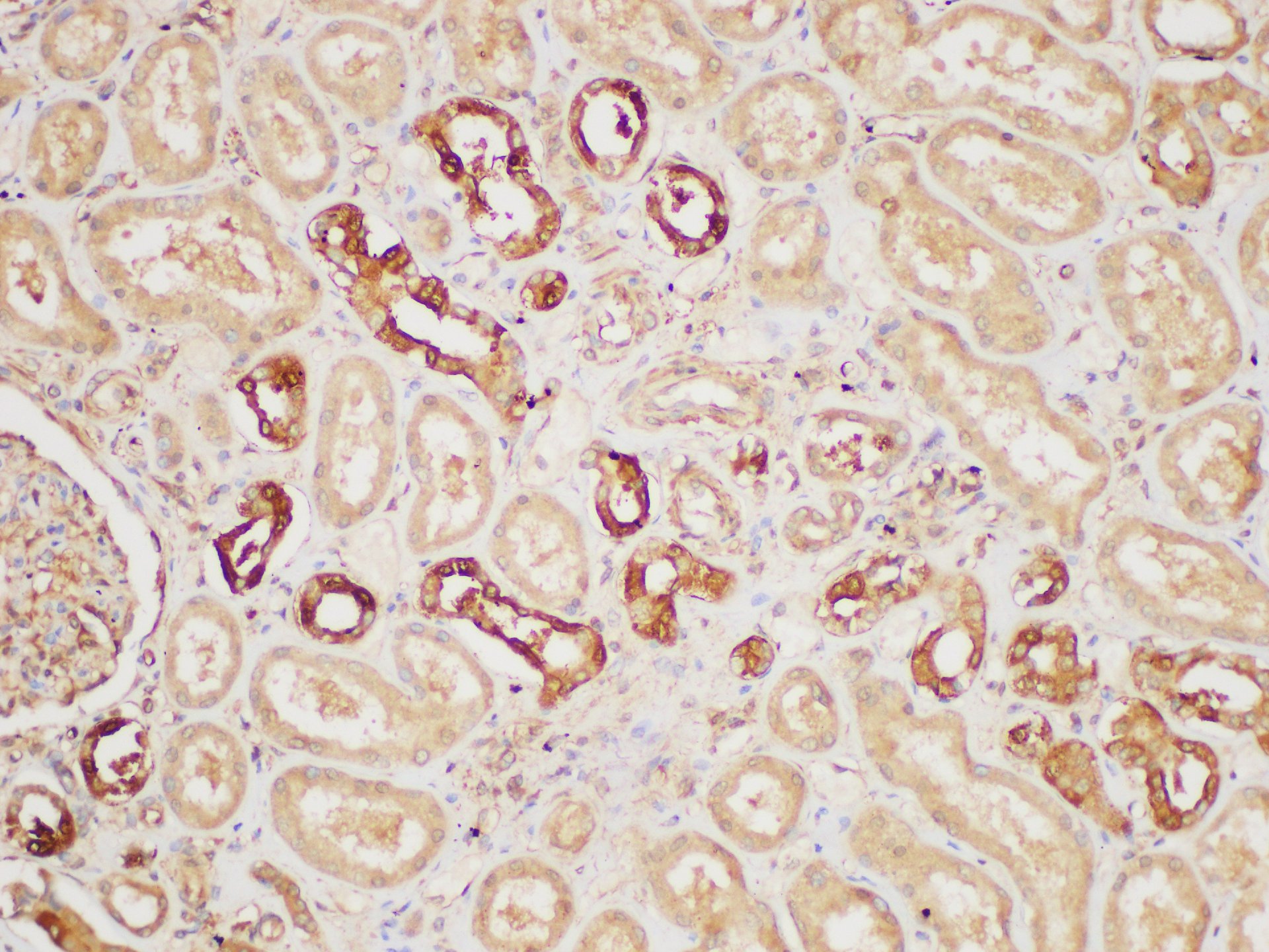 Immunohistochemistry of paraffin-embedded Human kidney using PAIP1 Polycloanl Antibody at dilution of 1:200