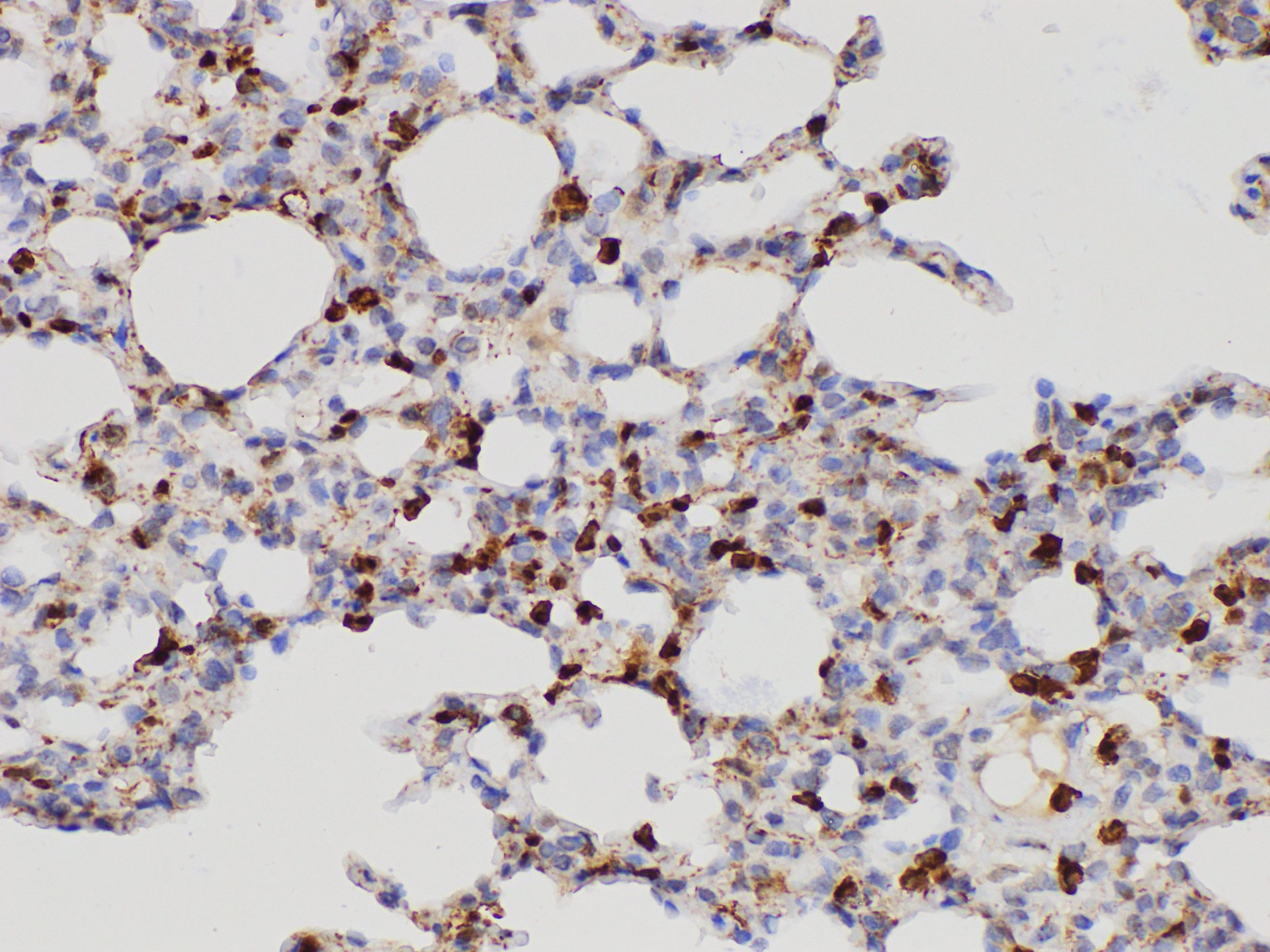 Immunohistochemistry of paraffin-embedded Rat lung using S100A4 Polycloanl Antibody at dilution of 1:200