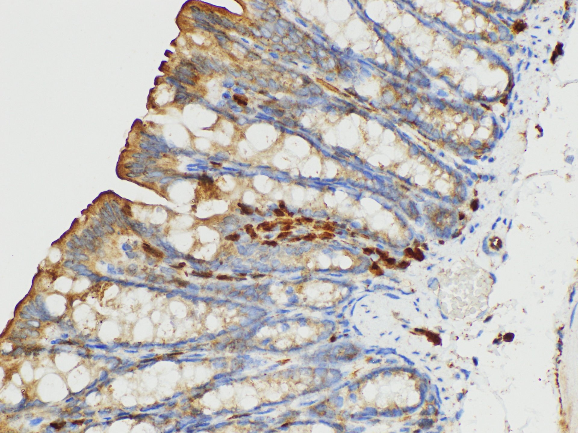 Immunohistochemistry of paraffin-embedded Mouse colon using S100A4 Polycloanl Antibody at dilution of 1:50