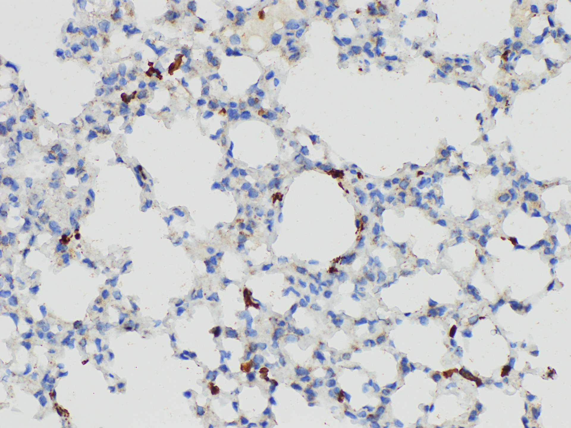 Immunohistochemistry of paraffin-embedded Mouse lung using S100A4 Polycloanl Antibody at dilution of 1:50