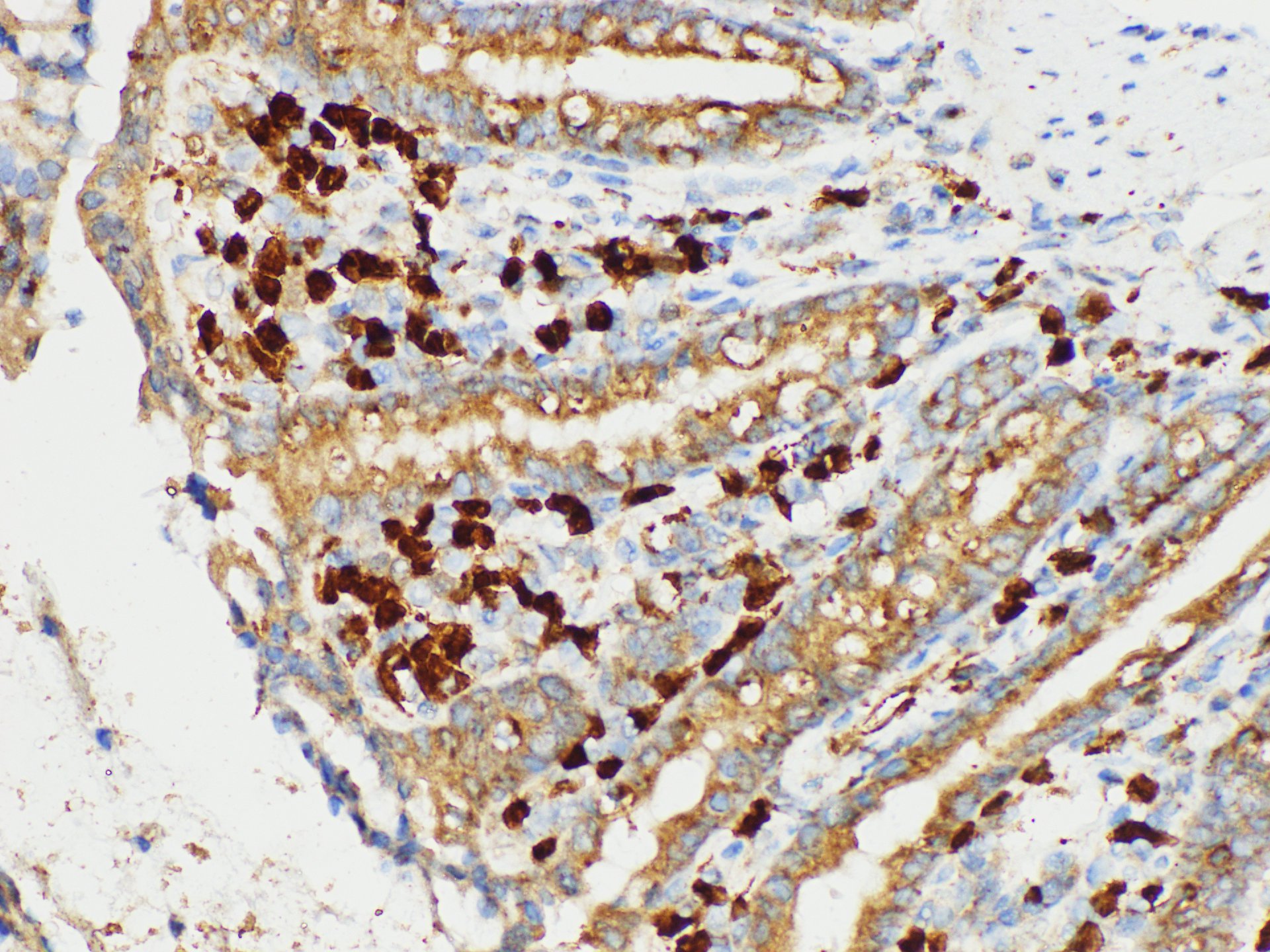 Immunohistochemistry of paraffin-embedded Rat colon using S100A4 Polycloanl Antibody at dilution of 1:50