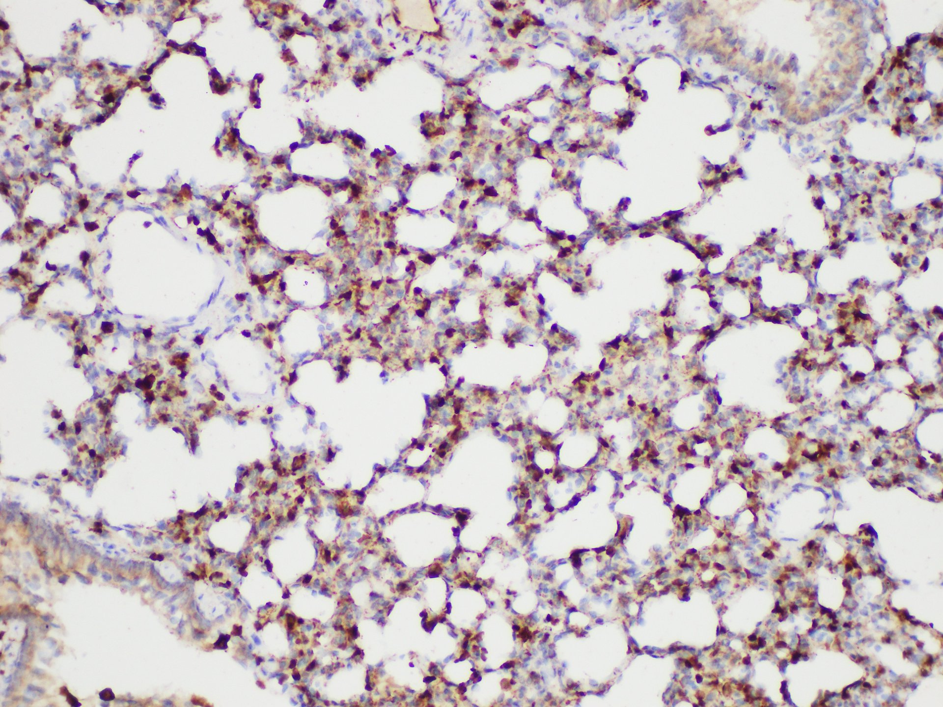 Immunohistochemistry of paraffin-embedded Rat lung using S100A4 Polycloanl Antibody at dilution of 1:50