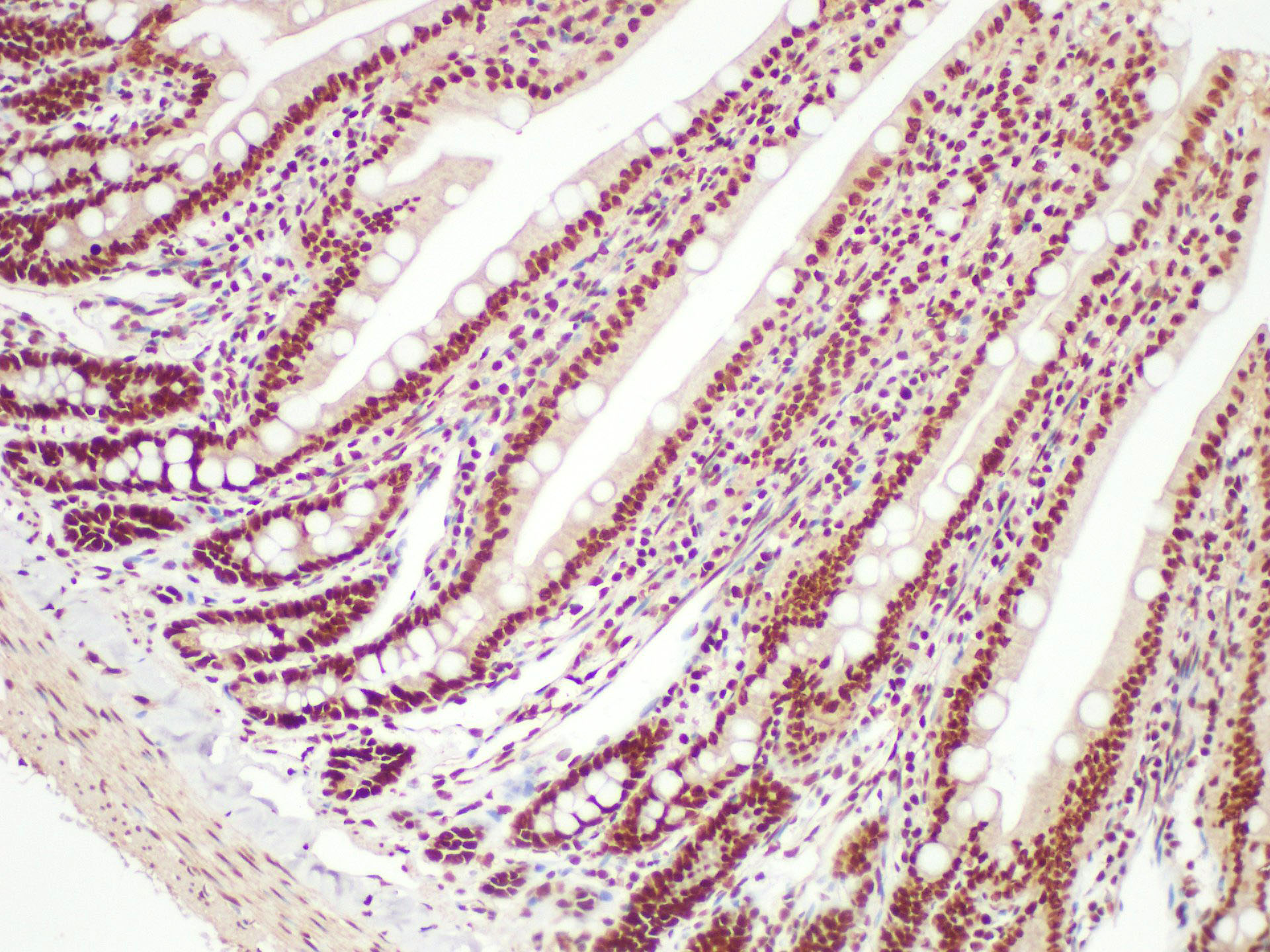 Immunohistochemistry of paraffin-embedded Rat colon using NPM1 Polycloanl Antibody at dilution of 1:200.