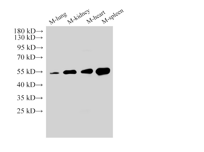 Western Blot analysis of 1)Mouse lung, 2)Mouse kidney, 3)Mouse heart, 4)Mouse spleen using Angiotensinogen Polyclonal Antibody at dilution of 1:3000.