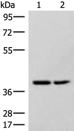 Western blot analysis of Hela and 231 cell lysates  using HPDL Polyclonal Antibody at dilution of 1:400