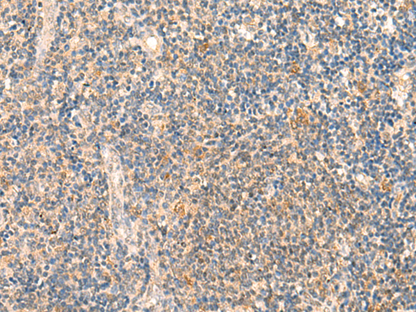 Immunohistochemistry of paraffin-embedded Human tonsil tissue  using HSPA4L Polyclonal Antibody at dilution of 1:30(×200)