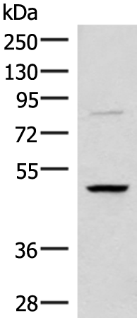 Western blot analysis of Human bladder transitional cell carcinoma grade 2-3 tissue lysate  using RRP8 Polyclonal Antibody at dilution of 1:800