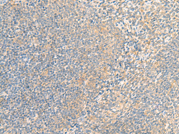 Immunohistochemistry of paraffin-embedded Human tonsil tissue  using IFNA5 Polyclonal Antibody at dilution of 1:35(×200)