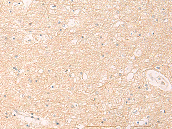 Immunohistochemistry of paraffin-embedded Human brain tissue  using ELP1 Polyclonal Antibody at dilution of 1:30(×200)