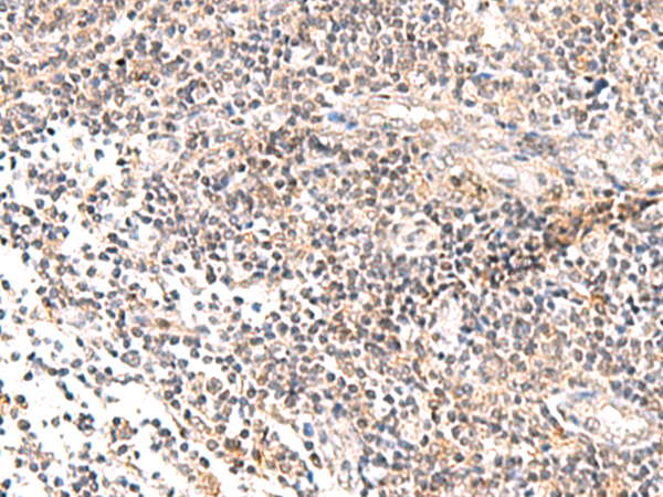 Immunohistochemistry of paraffin-embedded Human tonsil tissue  using IL36B Polyclonal Antibody at dilution of 1:40(×200)