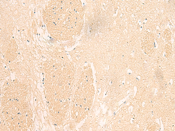 Immunohistochemistry of paraffin-embedded Human brain tissue  using IL37 Polyclonal Antibody at dilution of 1:50(×200)