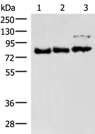 Western blot analysis of 231 A172 and HepG2 cell lysates  using FOXK2 Polyclonal Antibody at dilution of 1:800