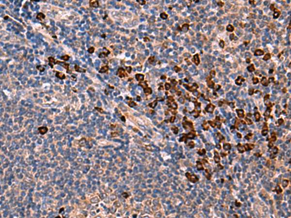 Immunohistochemistry of paraffin-embedded Human tonsil tissue  using INSM2 Polyclonal Antibody at dilution of 1:35(×200)