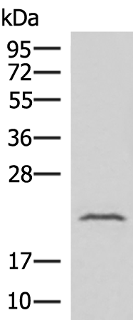 Western blot analysis of Human fetal liver tissue lysate  using IFNA8 Polyclonal Antibody at dilution of 1:500