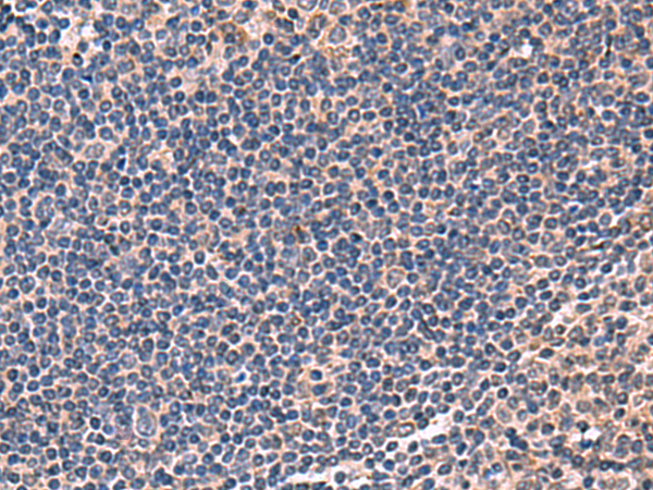 Immunohistochemistry of paraffin-embedded Human tonsil tissue  using IPPK Polyclonal Antibody at dilution of 1:50(×200)