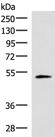 Western blot analysis of Human heart tissue lysate  using IRX1 Polyclonal Antibody at dilution of 1:400