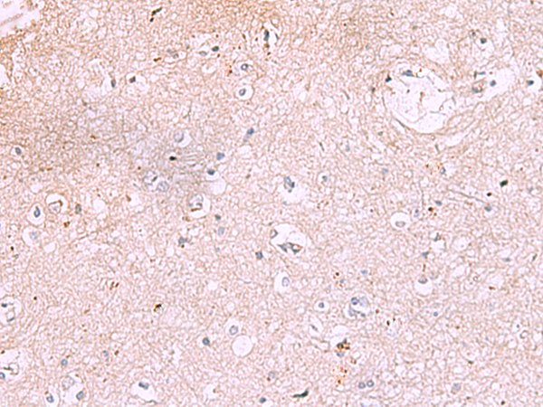 Immunohistochemistry of paraffin-embedded Human brain tissue  using IRX2 Polyclonal Antibody at dilution of 1:45(×200)