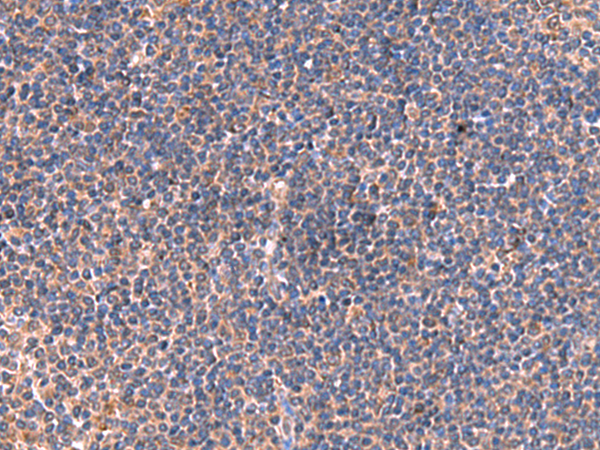 Immunohistochemistry of paraffin-embedded Human tonsil tissue  using ISM1 Polyclonal Antibody at dilution of 1:40(×200)