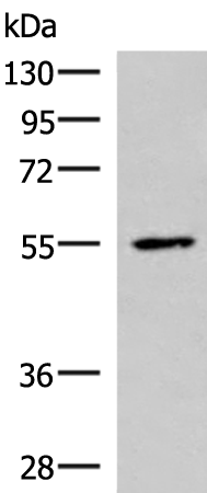 Western blot analysis of HepG2 cell lysate  using ISM1 Polyclonal Antibody at dilution of 1:1000