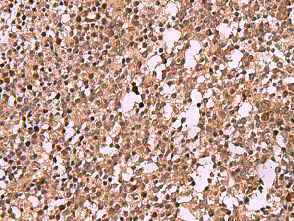 Immunohistochemistry of paraffin-embedded Human tonsil tissue  using IST1 Polyclonal Antibody at dilution of 1:40(×200)