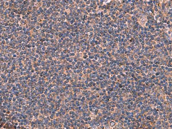 Immunohistochemistry of paraffin-embedded Human tonsil tissue  using ITGA11 Polyclonal Antibody at dilution of 1:50(×200)