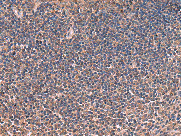 Immunohistochemistry of paraffin-embedded Human tonsil tissue  using ITIH4 Polyclonal Antibody at dilution of 1:30(×200)