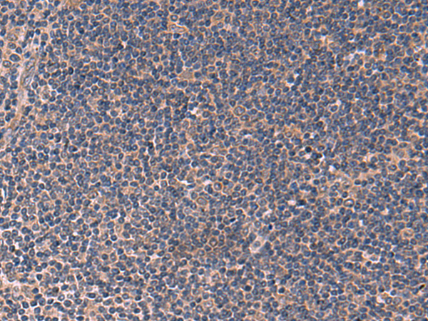 Immunohistochemistry of paraffin-embedded Human tonsil tissue  using ITPR2 Polyclonal Antibody at dilution of 1:60(×200)
