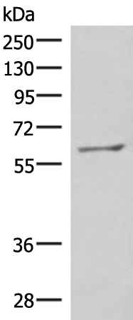Western blot analysis of RAW264.7 cell lysate  using MBTPS2 Polyclonal Antibody at dilution of 1:800