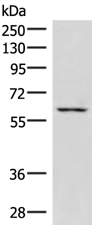 Western blot analysis of K562 cell lysate  using JRKL Polyclonal Antibody at dilution of 1:1000