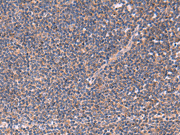 Immunohistochemistry of paraffin-embedded Human tonsil tissue  using JPH2 Polyclonal Antibody at dilution of 1:40(×200)