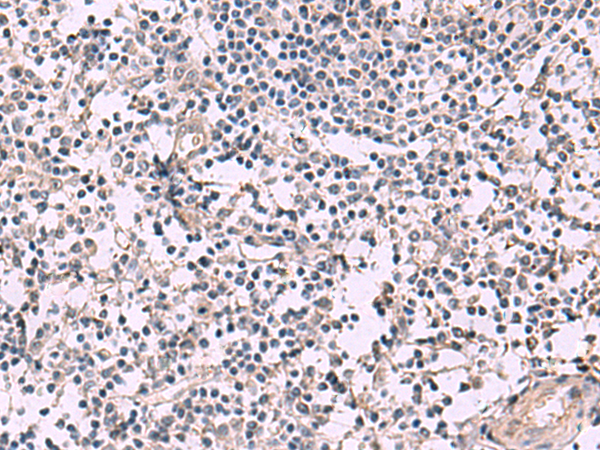 Immunohistochemistry of paraffin-embedded Human tonsil tissue  using KCNIP1 Polyclonal Antibody at dilution of 1:40(×200)