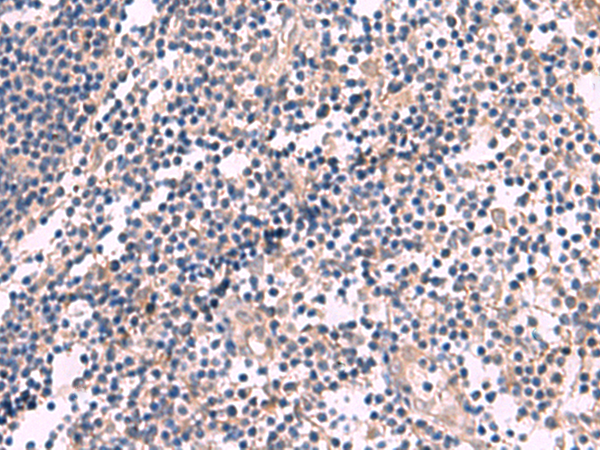 Immunohistochemistry of paraffin-embedded Human tonsil tissue  using KCNN3 Polyclonal Antibody at dilution of 1:60(×200)