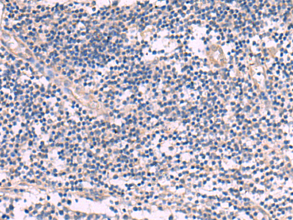 Immunohistochemistry of paraffin-embedded Human tonsil tissue  using NIPSNAP1 Polyclonal Antibody at dilution of 1:35(×200)