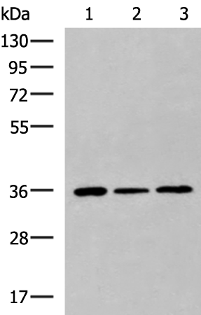 Western blot analysis of HepG2 Hela cell Mouse liver tissue lysates  using KHK Polyclonal Antibody at dilution of 1:1000