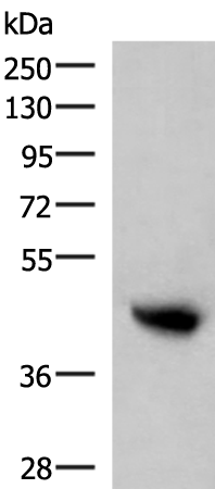 Western blot analysis of Human plasma solution  using KIR2DL5A Polyclonal Antibody at dilution of 1:800