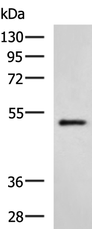 Western blot analysis of Hela cell lysate  using HTRA2 Polyclonal Antibody at dilution of 1:500