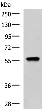 Western blot analysis of A549 cell lysate  using TERF1 Polyclonal Antibody at dilution of 1:1000