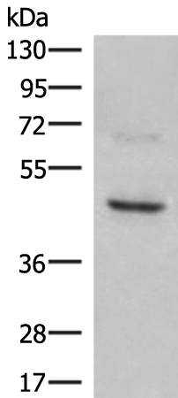 Western blot analysis of SKOV3 cell lysate  using NCR1 Polyclonal Antibody at dilution of 1:350