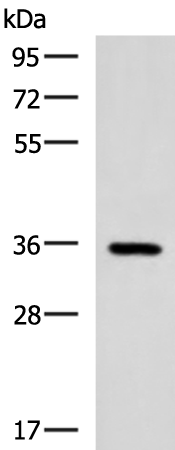 Western blot analysis of Mouse brain tissue lysate  using B3GAT1 Polyclonal Antibody at dilution of 1:650