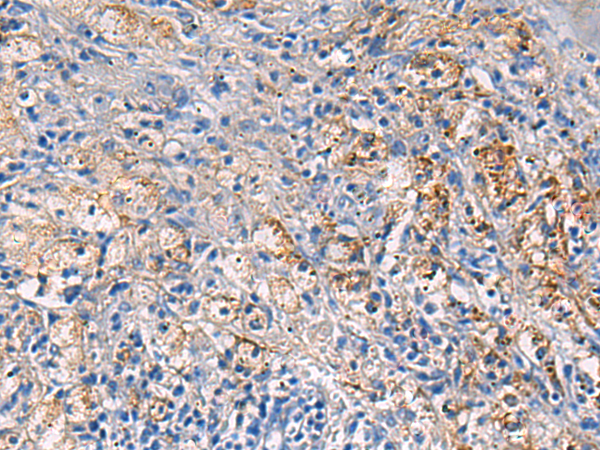 Immunohistochemistry of paraffin-embedded Human brain tissue  using NFKB1 Polyclonal Antibody at dilution of 1:80(×200)