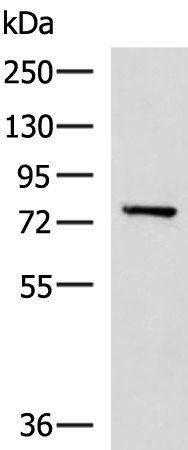 Western blot analysis of Mouse brain tissue lysate  using CAPN5 Polyclonal Antibody at dilution of 1:550