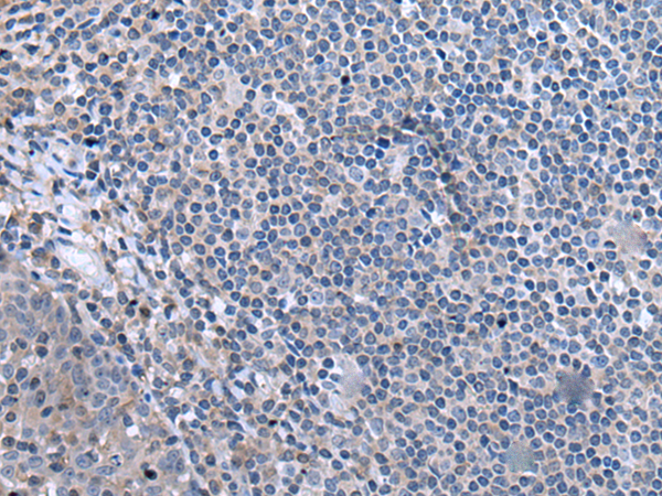 Immunohistochemistry of paraffin-embedded Human tonsil tissue  using CCK Polyclonal Antibody at dilution of 1:55. (Original magnific at ion: ×200) at dilution of 1:55(×200)