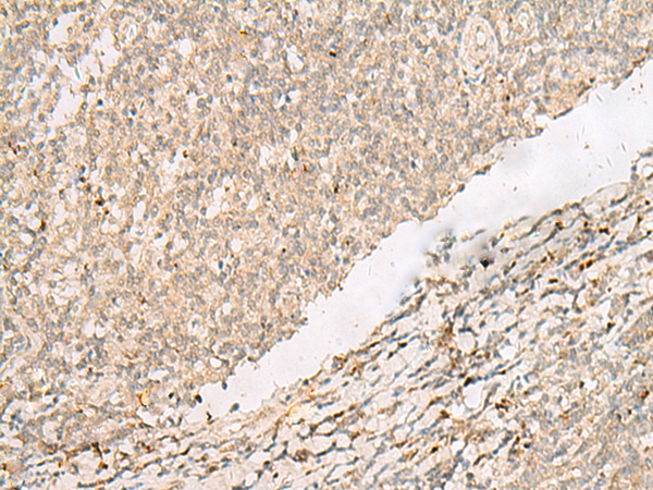 Immunohistochemistry of paraffin-embedded Human tonsil tissue  using PADI4 Polyclonal Antibody at dilution of 1:35(×200)