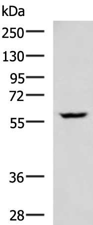 Western blot analysis of LOVO cell lysate  using PDCD4 Polyclonal Antibody at dilution of 1:400