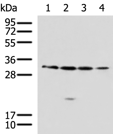 Western blot analysis of 293T A549 Jurkat 231 cell lysates  using RCHY1 Polyclonal Antibody at dilution of 1:650