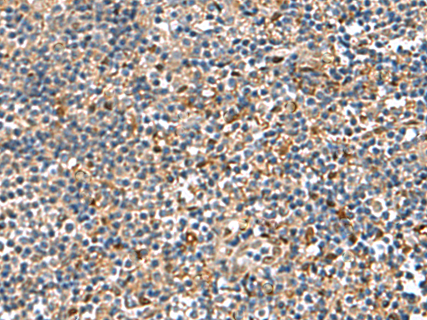 Immunohistochemistry of paraffin-embedded Human tonsil tissue  using TGFBI Polyclonal Antibody at dilution of 1:75(×200)