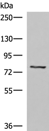 Western blot analysis of 293T cell lysate  using TGFBI Polyclonal Antibody at dilution of 1:1050